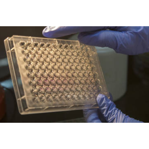 [CSB-PA001266LA01HU] ELISA  ACYP2 anti-